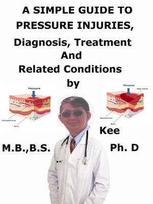 cover image of A Simple Guide to Pressure Injuries, Diagnosis, Treatment and Related Conditions